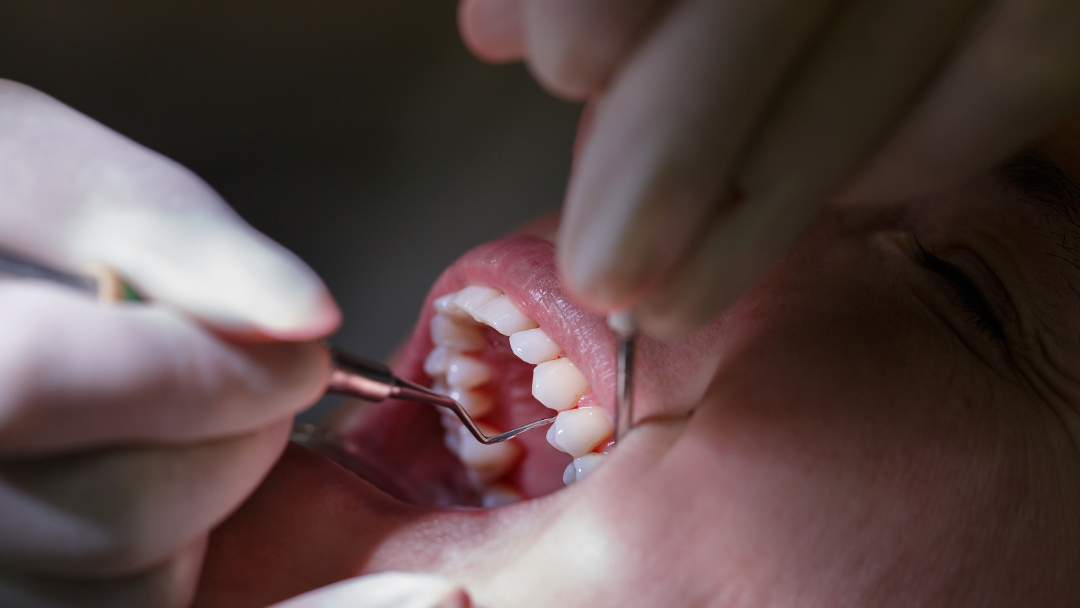 Why I Left Dental Hygiene